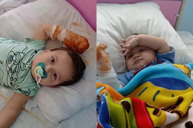 İki yaşlı Salehin dəstəyə ehtiyacı var: Ayağı və qolu tamamilə yanıb - FOTO