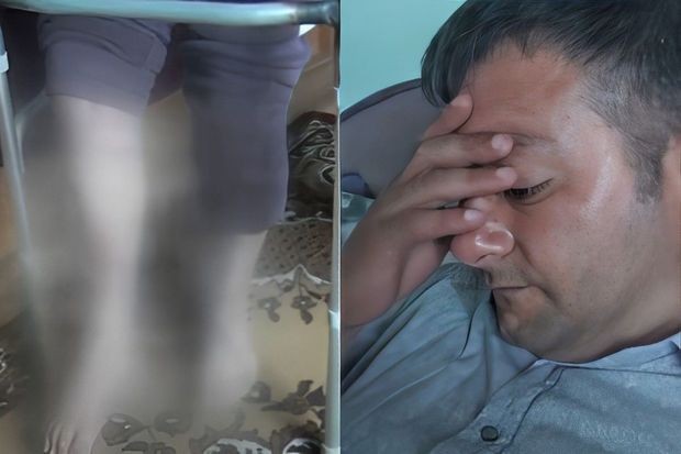 Fiziki məhdudiyyətli şəxsə əlillik təyin edilmir: “Məni get-gələ salıblar” - VİDEO