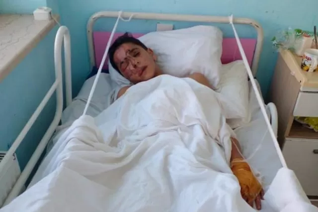 14 yaşlı yeniyetmə qıcolması tutduğuna görə ocağın içinə yıxılıb: Müalicələri yarımçıq qalıb