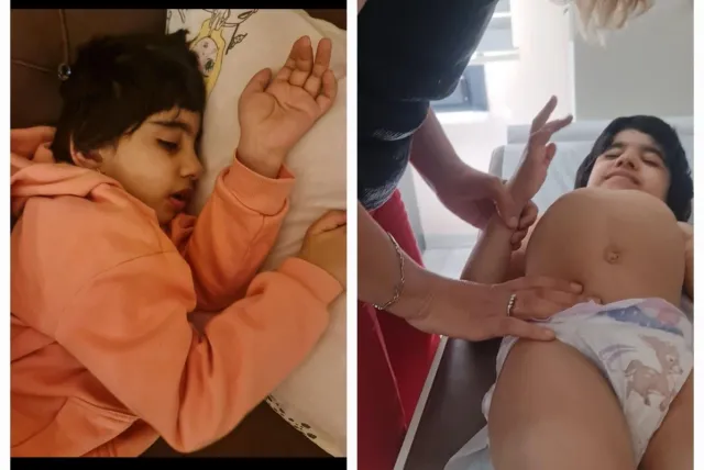 İki ağır xəstəliklə mübarizə aparan Nurayın dəstəyə ehtiyacı var