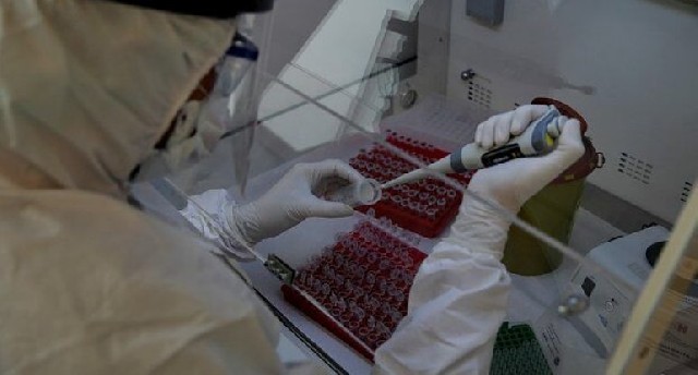 Fəlakət gəlir: "COVID-19"dan da betər virus aşkarlandı